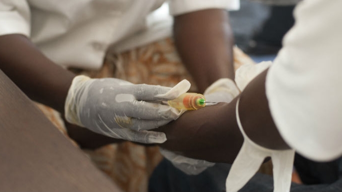 Tuberculose en Guinée : entre efforts de riposte et défis persistants dans la prise en charge des patients