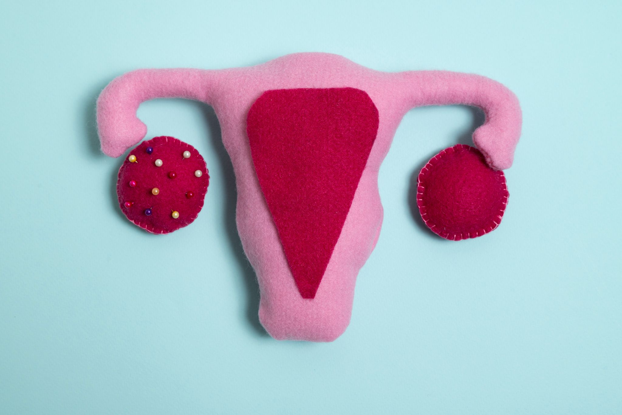 Cancer de l’ovaire : une menace discrète mais redoutable pour les femmes, surtout celles de plus de 50 ans