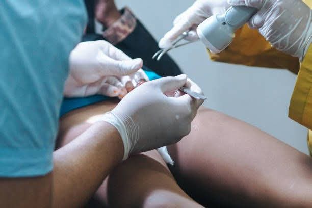 Circoncision : bénéfices, risques, âge idéal… Un médecin donne de précieux conseils !