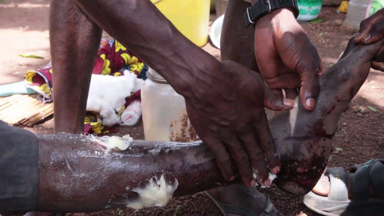 Kankan : à Banankoni, une famille perpétue un savoir-faire traditionnel autour des fractures