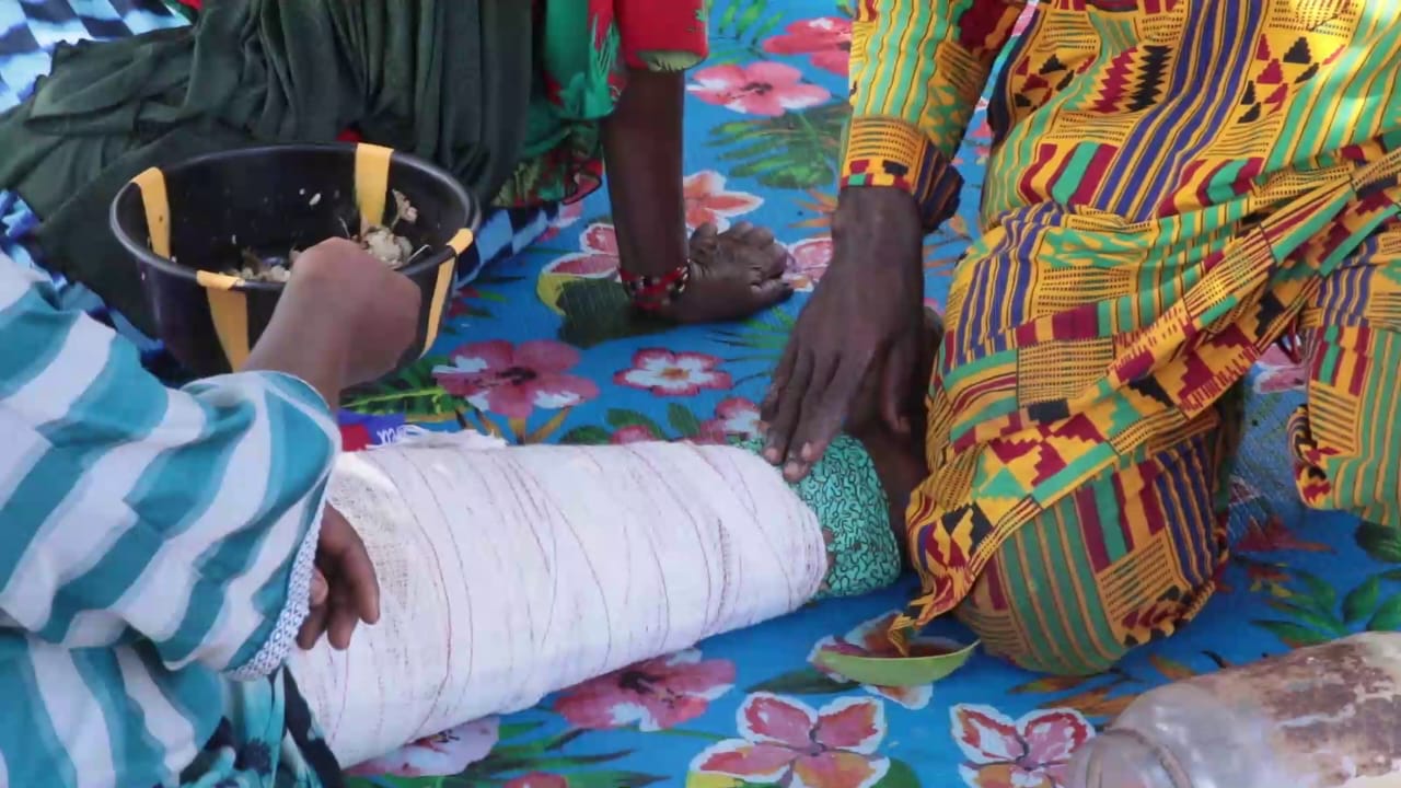Kankan : à Banankoni, une famille perpétue un savoir-faire traditionnel autour des fractures